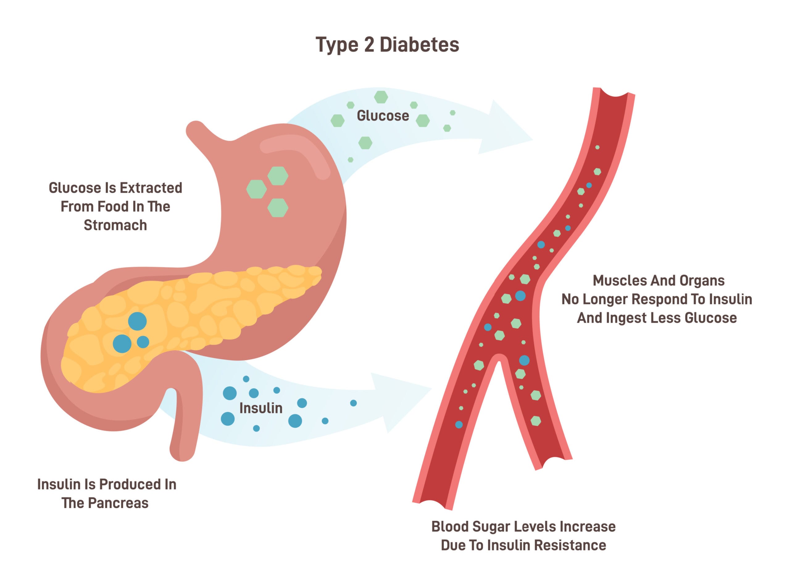 Obesity / Type 20 Diabetes   Konstantinos Konstantinidis